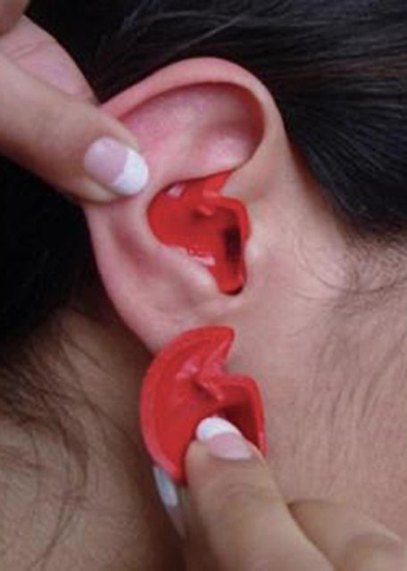 Doc's Proplugs Vented XXL transparant in het oor geplaatst tijdens gebruik Doc's Proplugs Vented XXL transparant in het oor geplaatst tijdens gebruik